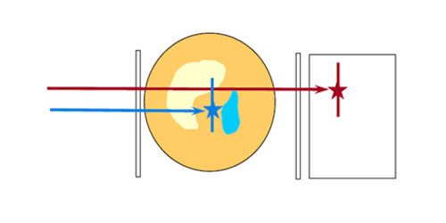 Linac booster for high energy proton therapy and imaging | Phys. Rev ...