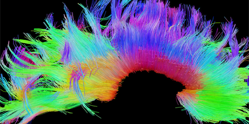 En el cerebro, la función sigue un patrón