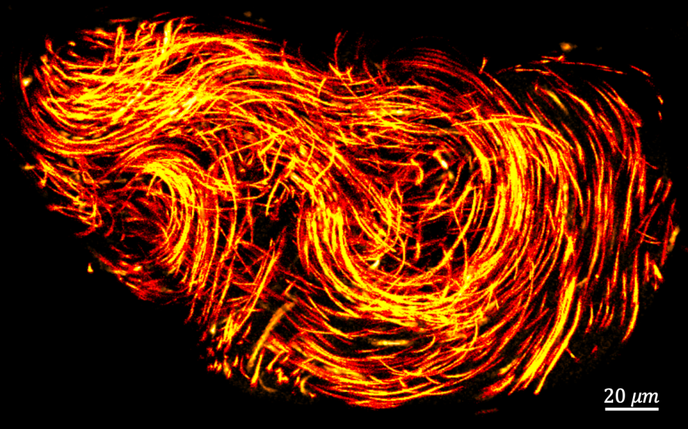 Figure caption