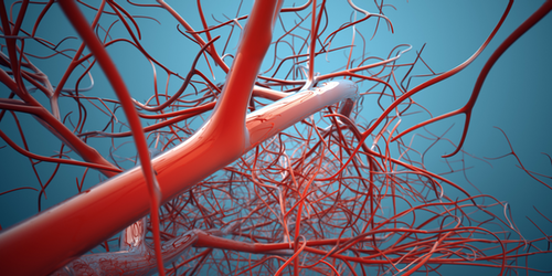 noncompressible calcified vessel meaning